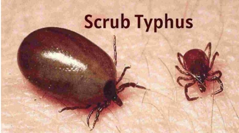 Shimla district records new 11 cases of Scrub Typhus: CMO HIMACHAL HEADLINES