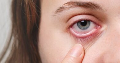 Many students contracted Eye Flu in the Arki subdivision HIMACHAL HEADLINES
